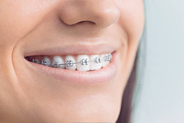 Best Teeth Whitening  in Campbellsburg, KY